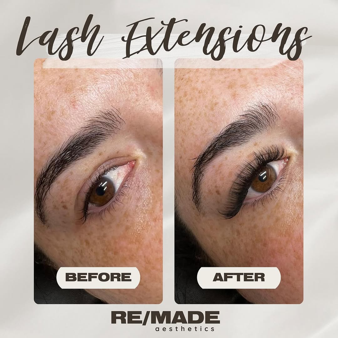 RE/MADE Esthetics client results and treatment photos from Instagram