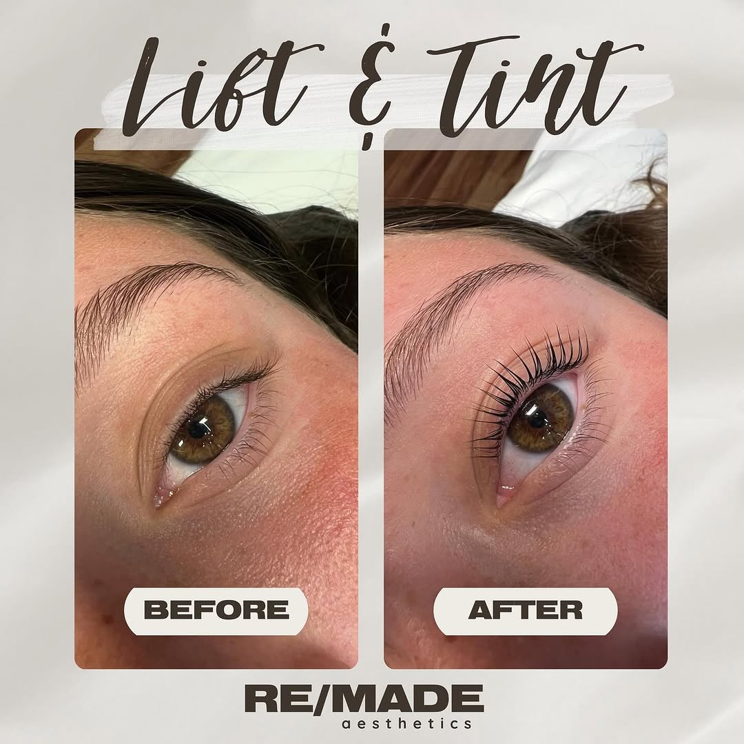 RE/MADE Esthetics client results and treatment photos from Instagram